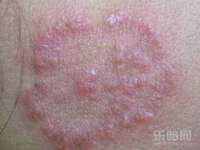 丹东市振兴区派特生物皮肤病研究所