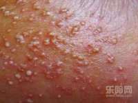 丹东市振兴区派特生物皮肤病研究所
